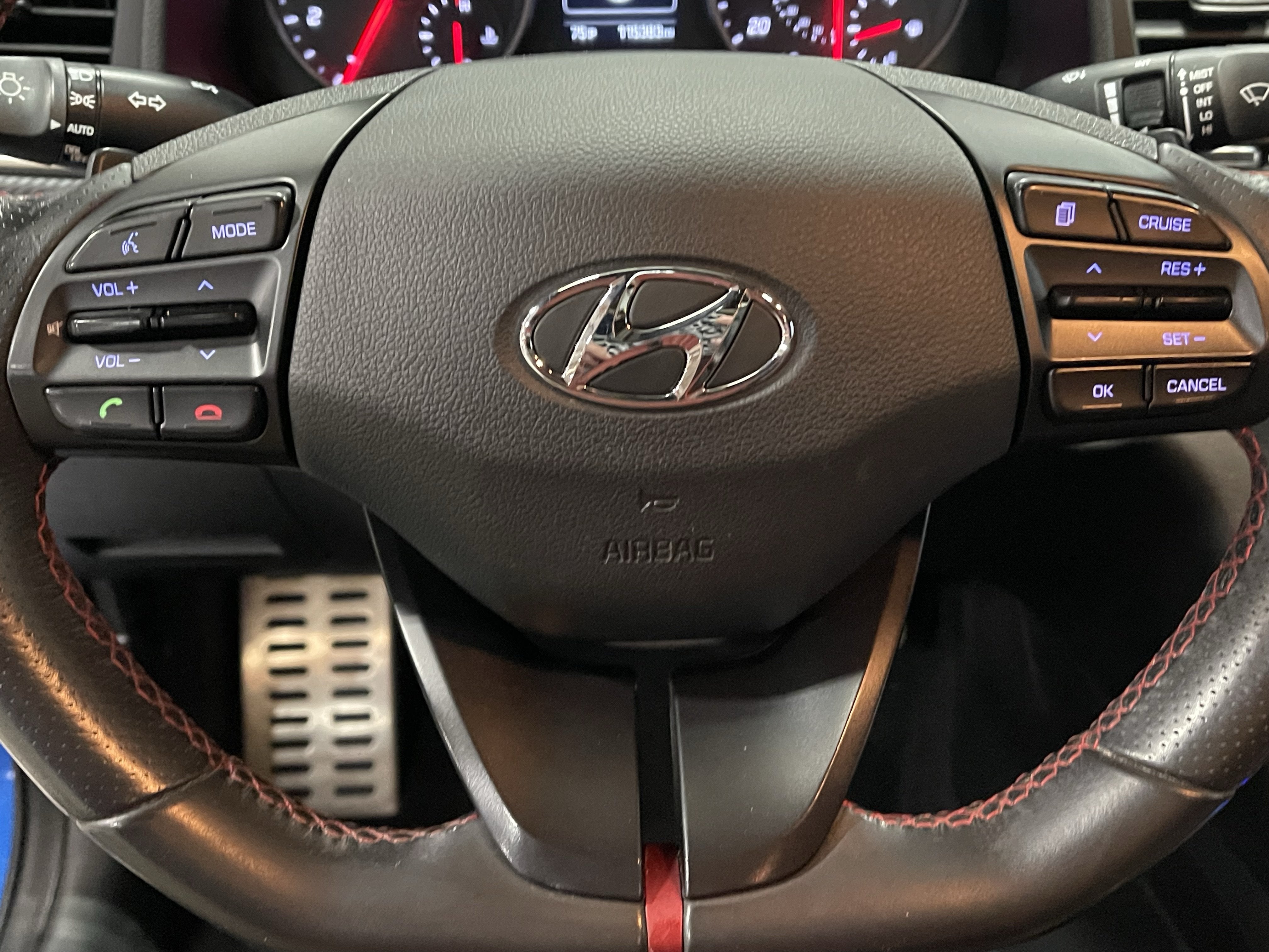 2018 Hyundai ELANTRA Sport