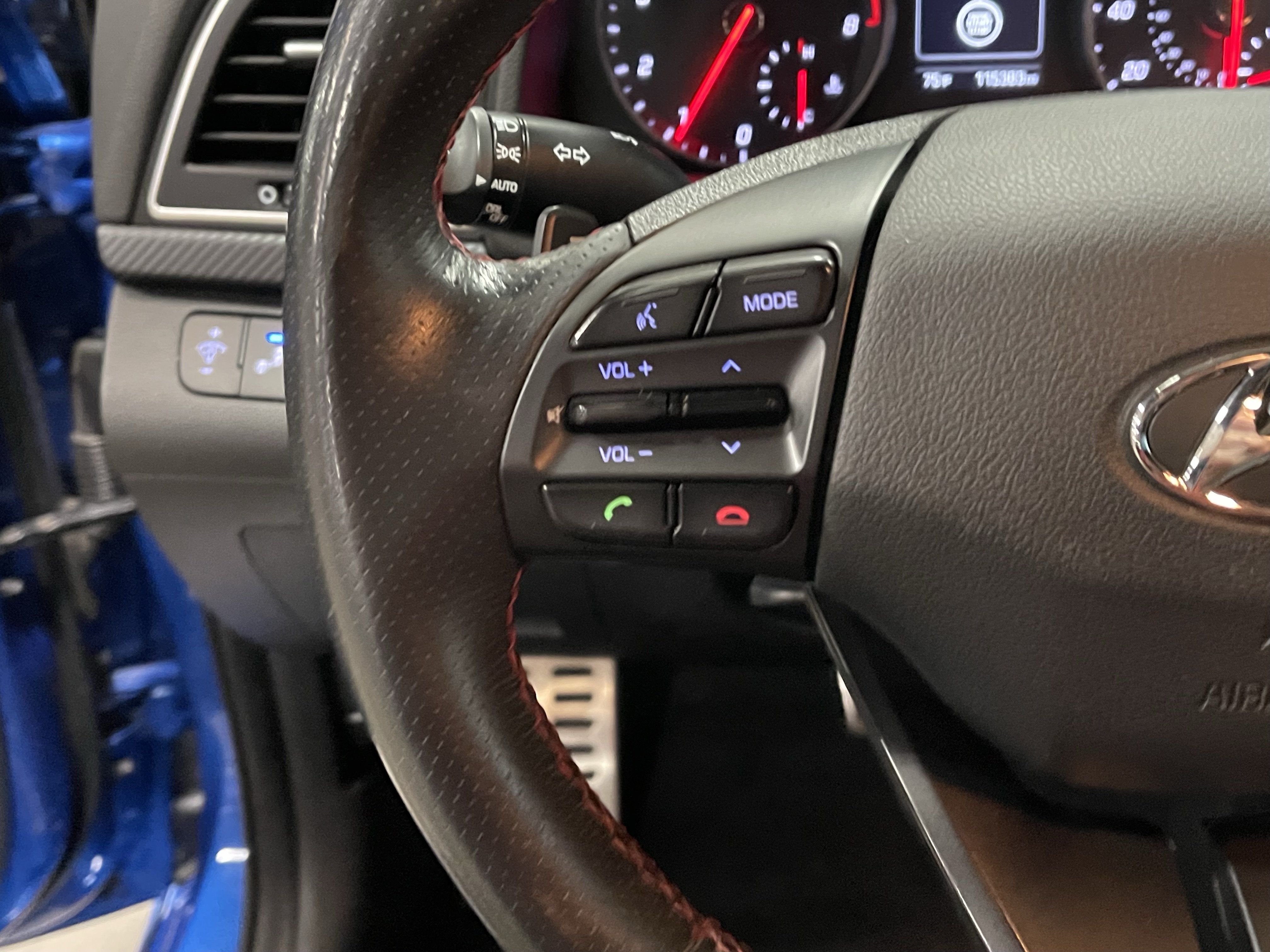 2018 Hyundai ELANTRA Sport